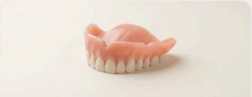 Printed digital denture with pink base and full arch of teeth