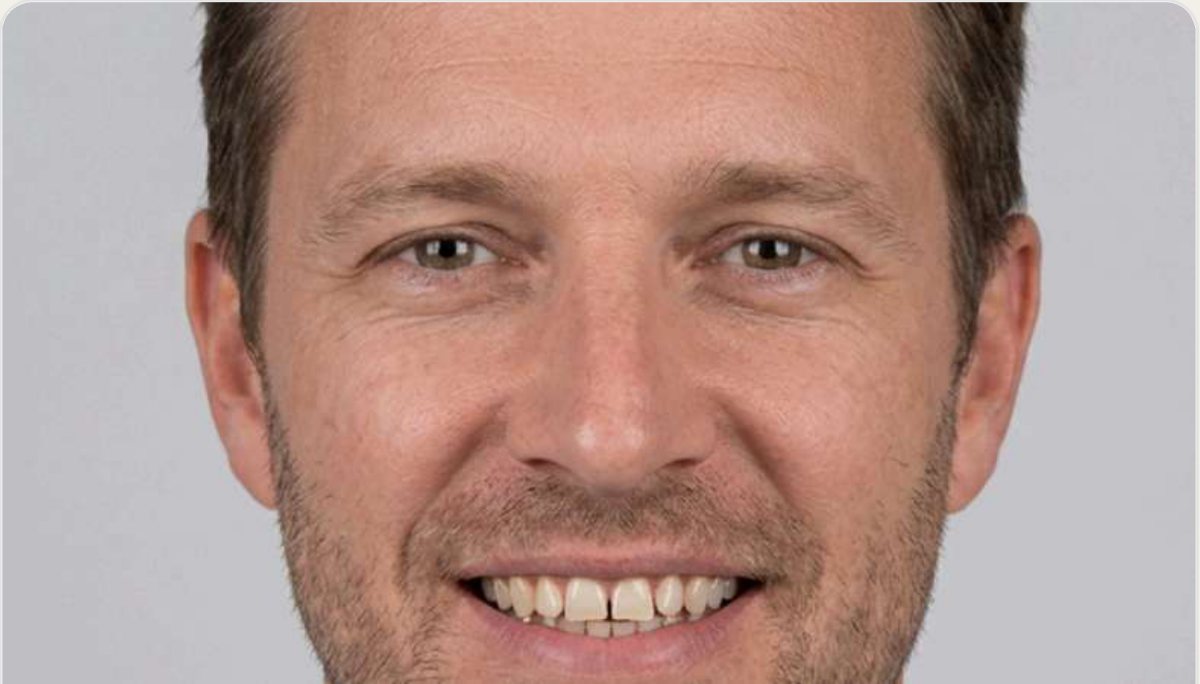 Portrait of a smiling person before treatment simulation
